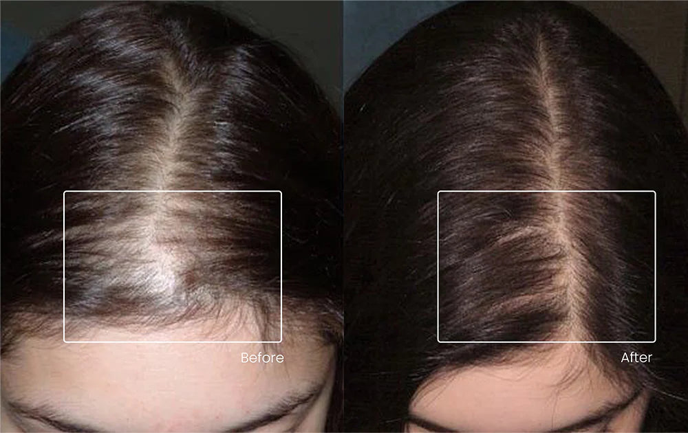 Before_and_After_1_2cd2cfbf-3cee-427d-926c-526caa48812d.webp